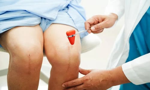 Невролог Опрелянський Максим Петрович